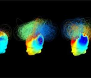 Brain images of vegetative vs. healthy adults.  Photo from article.  See: http://www.sciencedaily.com/releases/2014/10/141016143706.htm