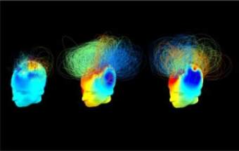 Brain images of vegetative vs. healthy adults.  Photo from article.  See: http://www.sciencedaily.com/releases/2014/10/141016143706.htm